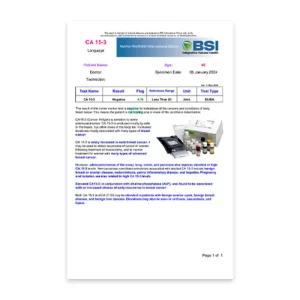 CA 15-3 Cancer Antigen