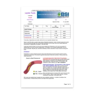 Lipids Profile